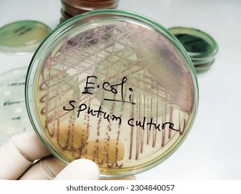 Microbiologist holding petri dish for Sputum culture test showing a colony of E. coli bacterium.