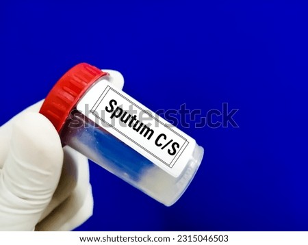Microbiologist holding sample container with specimen for Sputum Culture test.
