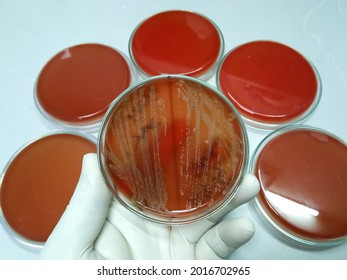 Microbiologist show bacterial growth on Blood agar medium at medical microbiology laboratory. Streptococcus pneumoniae, Staphylococcus aureus bacteria colonies 