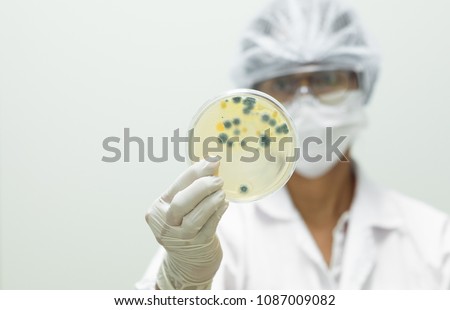 Microbiologist wear sterile gloves and holding the petri dish with yellow colony of fungi, concept of microbial laboratory in pharmaceutical industry.