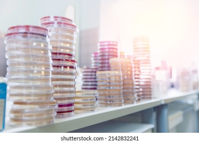 Microbiology concept, hand of medical worker on agar plate culture bacteria, resistance of pathogens and bacterial identification in lab.