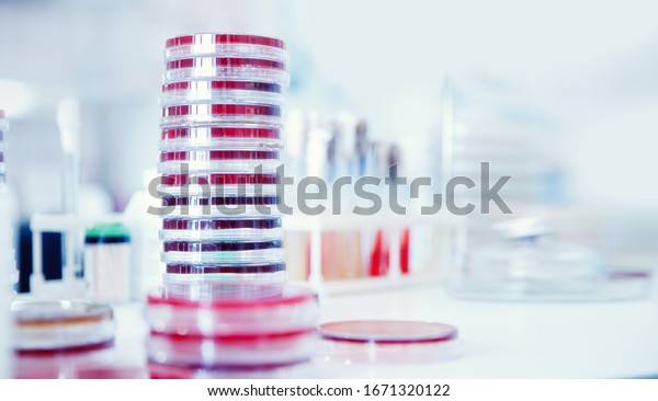 Microbiology laboratory\
agar plate full of micro bacterias and microorganisms E. coli grow\
biological\
samples.