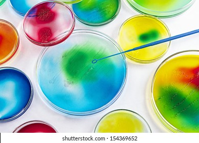 Microbiology - seeding petri dishes