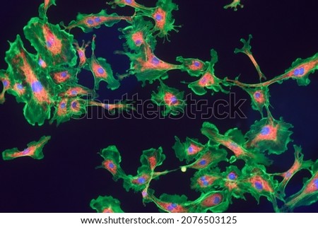 Microfilaments, mitochondria, and nuclei in fibroblast cells