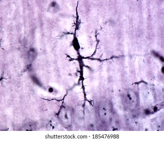 Microglia cell stained with Rio Hortega's silver carbonate method. This ramified or "resting" microglia appears in normal brain tissue.