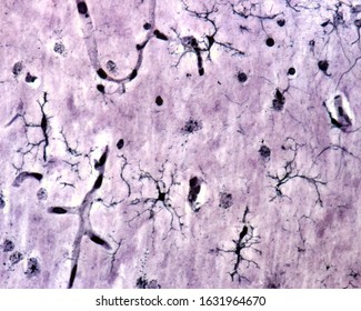 Microglia cells stained with Rio Hortega's silver carbonate method in the grey matter of the brain. This type is the ramified or "resting" microglia that appears in normal brain tissue.