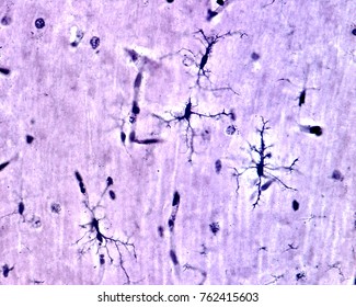 Microglia cells stained with Rio Hortega's silver carbonate method in the grey matter of the brain. This type is the ramified or "resting" microglia that appears in normal brain tissue.
