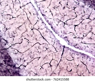 Microglia in the molecular layer of the cerebellar cortex. The thick dark lines, often curved, visible in the image are blood capillaries. Silver carbonate from Rio-Hortega