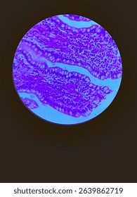 Micrograph of epithelial tissue in cross section of a tissue, with several layers of cells visible, including a denser outer layer and more irregular inner layers.