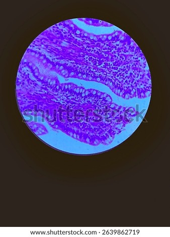 Micrograph of epithelial tissue in cross section of a tissue, with several layers of cells visible, including a denser outer layer and more irregular inner layers.