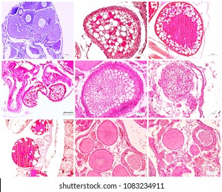 Micrograph Of Ovary Showing Ovarian Follicles