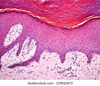 Micrograph showing the epidermis and dermis of a human finger skin. The layers of  this keratinized stratified squamous epithelium are clearly seen. H&E stain