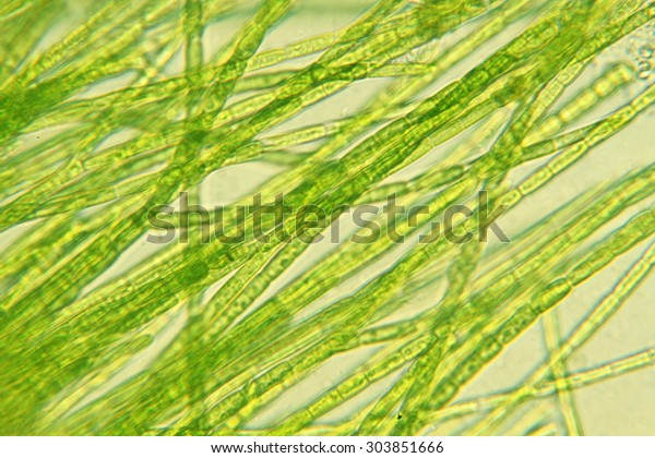 Microorganism Algae Stock Photo (Edit Now) 303851666