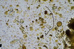 Microorganisms And Biology In Compost And Soil Sample Under The Microscope 