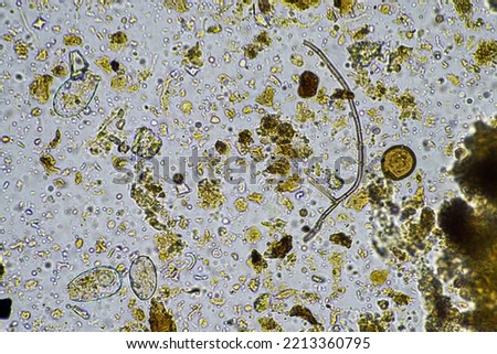 Microorganisms and biology in Compost and soil sample under the microscope  Foto stock © 