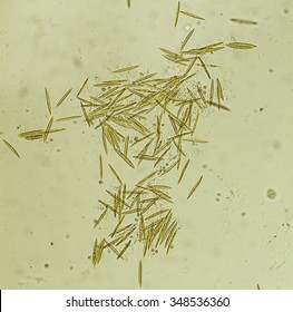 Microorganisms - Diatoms