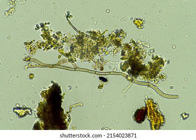 Microorganisms And Soil Biology, With Nematodes And Fungi Under The Microscope.