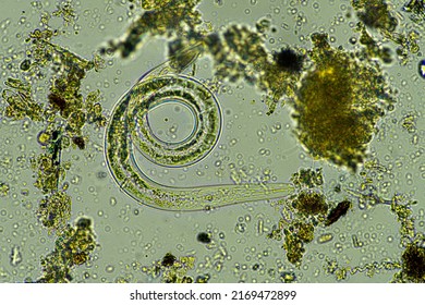 microorganisms and soil biology, with nematodes and fungi under the microscope. in a soil and compost sample - Shutterstock ID 2169472899