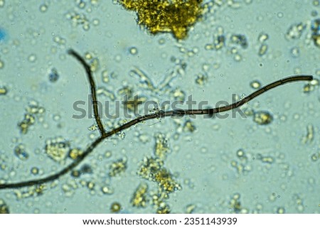 microorganisms under a microscope at 400x magnification in a sample