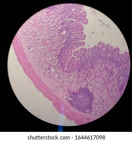 Microphotograpy Of Duodenum With MALT And Brunner's Glands