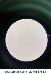 Microscope field view with minimal sample of cornea, representing koh preparation in laboratory practice.