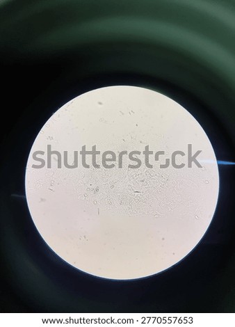 Microscope field view with minimal sample of cornea, representing koh preparation in laboratory practice.