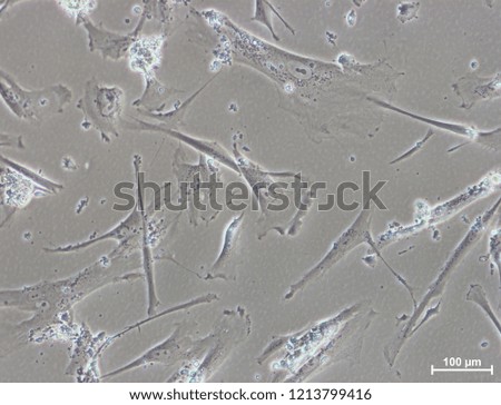 microscope image of cultured cells (HCMEC, human cardiac microvascular endothelial cells)