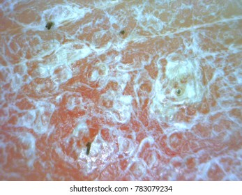 Microscope Image Psoriasis Closeup Macro Image Stock Photo 783079234 ...