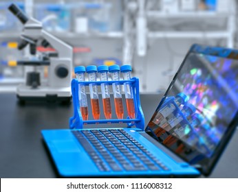 Microscope, liquid samples and portable computer with microscopic image on observation table, set up in modern laboratory