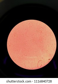 microscope Magnification Budding yeast with pseudohyphae in urine