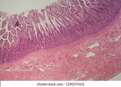 Microscope Photo Human Large Intestine Section Stock Photo 1290575101 ...