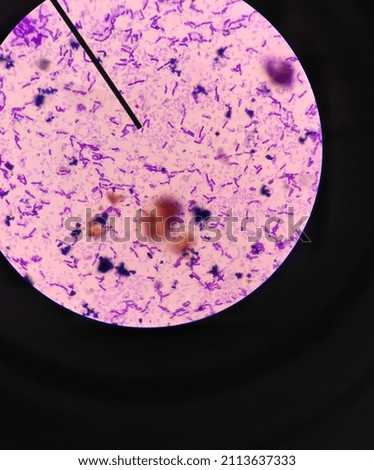 Microscope picture of e-coli bacteria 