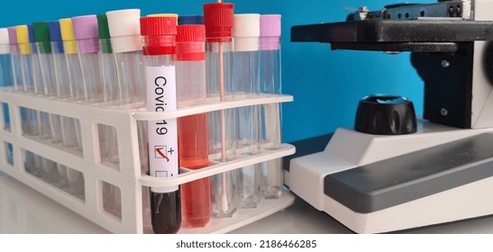 Microscope And Positive In Vitro Test For Coronavirus Infection. Laboratory Research Covid 19 Concept