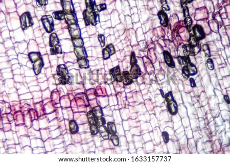 Microscope stained slide of cork cells.