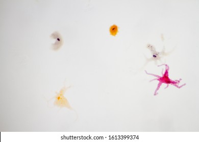 Microscope view of an amoeba which can cause dysentery.