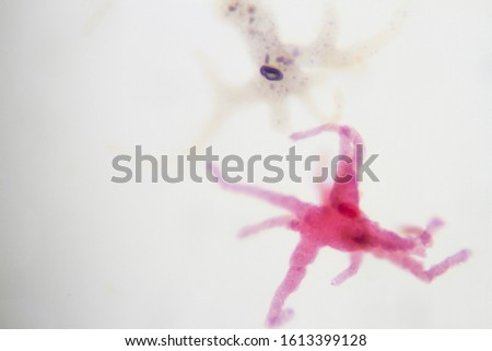 Microscope view of an amoeba which can cause dysentery.