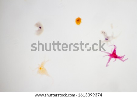 Microscope view of an amoeba which can cause dysentery.