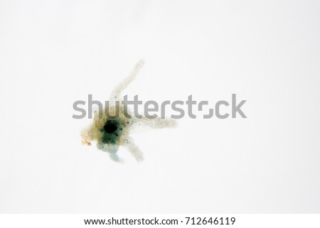 microscope view of an amoeba which can cause dysentery.