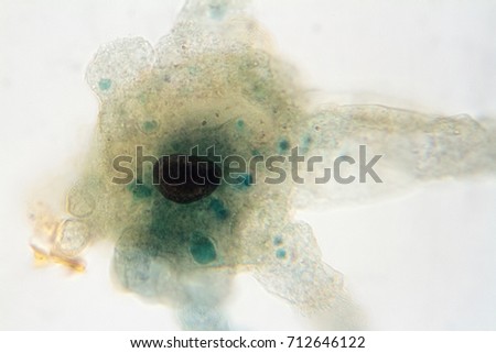 microscope view of an amoeba which can cause dysentery.