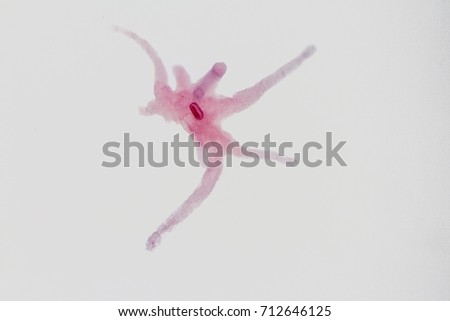 microscope view of an amoeba which can cause dysentery.