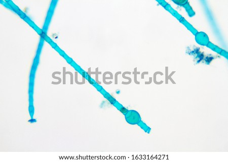 Microscope view of freshwater algae Oedogonium.