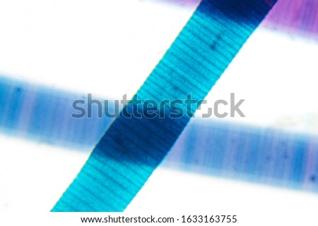 Microscope view of freshwater algae Oscillatoria.