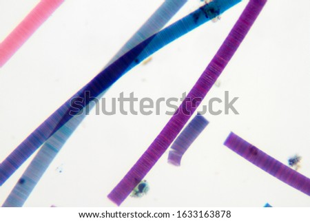 Microscope view of freshwater algae Oscillatoria.