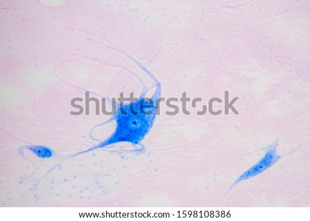 Microscope view of giant multipolar neuron.