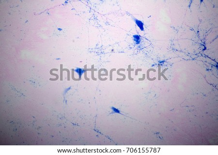 Microscope view of giant multipolar neuron