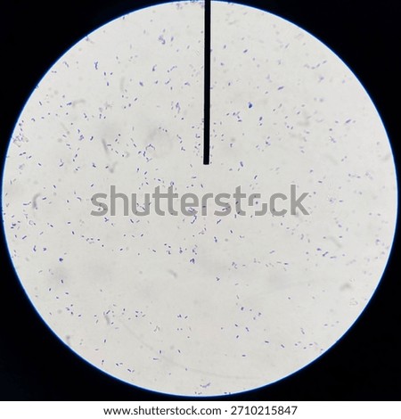 Microscope view of Gram positive bacilli bacteria stained purple with a pointer needle indicating cells for microbiology education