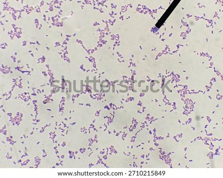 Microscope view of Gram positive bacilli bacteria stained purple showing pleomorphic rods and a pointer needle indicating Corynebacterium species