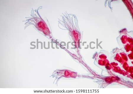 Microscope view of Obelia hydroid, a marine and sometimes freshwater animal.
