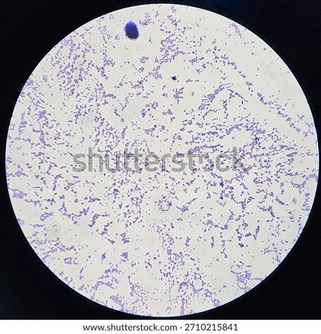 Microscope view of scattered Gram positive bacilli bacteria stained purple showing small pleomorphic rod shaped morphology for microbiology analysis