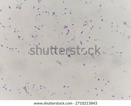 Microscope view of scattered Gram positive bacilli bacteria stained purple showing small pleomorphic rod shaped morphology for microbiology analysis